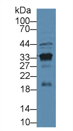 Polyclonal Antibody to Prostate Specific Antigen (PSA)