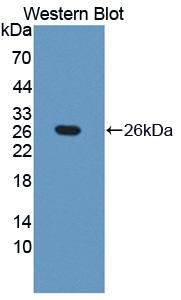 Polyclonal Antibody to Alpha-Fetoprotein (AFP)