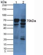 Polyclonal Antibody to Alpha-Fetoprotein (AFP)