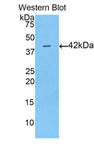 Polyclonal Antibody to Alpha-Fetoprotein (AFP)