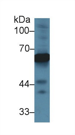 Polyclonal Antibody to Alpha-Fetoprotein (AFP)