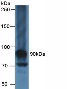 Polyclonal Antibody to Carbohydrate Antigen 125 (CA125)