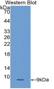 Polyclonal Antibody to Serpin Peptidase Inhibitor,Clade B,Member 4 (SERPINB4)