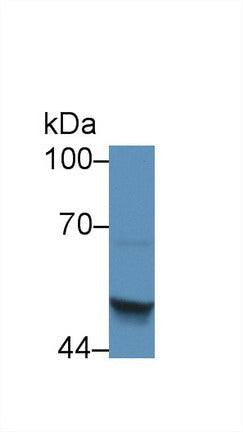 Polyclonal Antibody to Serpin Peptidase Inhibitor,Clade B,Member 4 (SERPINB4)