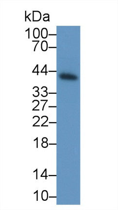 Polyclonal Antibody to Pepsinogen C (PGC)