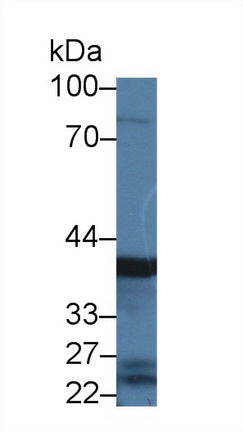 Polyclonal Antibody to Pepsinogen C (PGC)