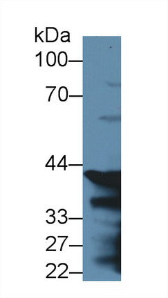 Polyclonal Antibody to Pepsinogen C (PGC)