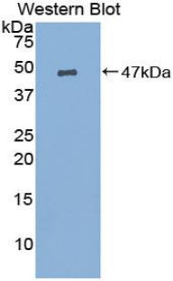 Polyclonal Antibody to Prostaglandin E Synthase, Microsomal (PTGES)