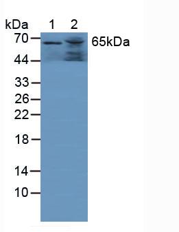 Polyclonal Antibody to Glucosidase Alpha, Acid (GaA)