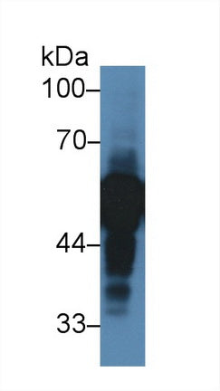 Polyclonal Antibody to Alpha-2-Heremans Schmid Glycoprotein (AHSG)