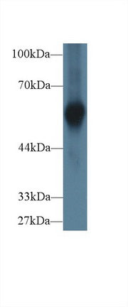 Polyclonal Antibody to Alpha-2-Heremans Schmid Glycoprotein (AHSG)