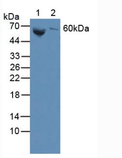 Polyclonal Antibody to Galactosidase Beta (GLb)