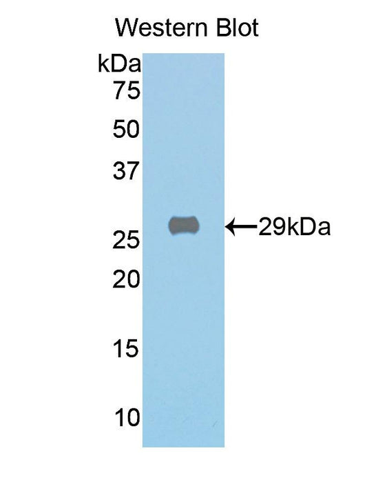 Polyclonal Antibody to Galactosidase Beta (GLb)