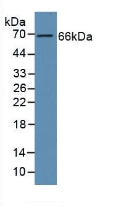 Polyclonal Antibody to Growth Arrest Specific Protein 6 (GAS6)