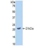 Polyclonal Antibody to Growth Arrest Specific Protein 6 (GAS6)