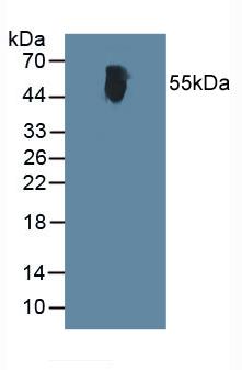 Polyclonal Antibody to Alanine Aminotransferase (ALT)