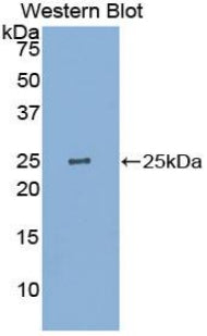 Polyclonal Antibody to Pyruvate kinase isozymes R/L (PKLR)