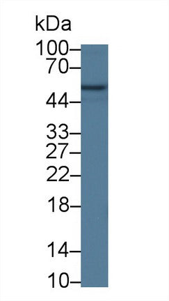 Polyclonal Antibody to Pyruvate kinase isozymes R/L (PKLR)