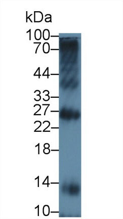 Polyclonal Antibody to Triggering Receptor Expressed On Myeloid Cells 1 (TREM1)