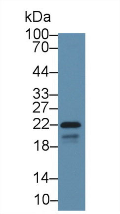 Polyclonal Antibody to Caveolin 1 (CAV1)