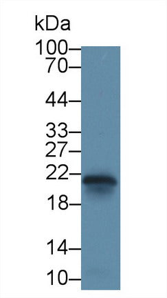 Polyclonal Antibody to Caveolin 1 (CAV1)