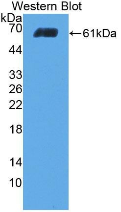 Polyclonal Antibody to Collagen Type I Alpha 2 (COL1a2)