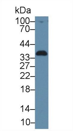 Polyclonal Antibody to Alpha-1-Microglobulin (a1M)