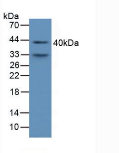 Polyclonal Antibody to Alpha-1-Microglobulin (a1M)