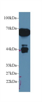 Polyclonal Antibody to Alpha-1-Microglobulin (a1M)