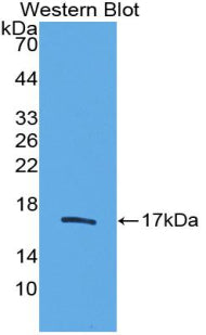 Polyclonal Antibody to Transforming Growth Factor Beta 2 (TGFb2)