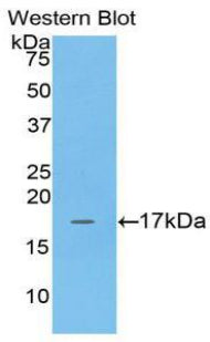 Polyclonal Antibody to Adrenomedullin (ADM)