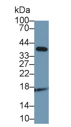 Polyclonal Antibody to Adrenomedullin (ADM)