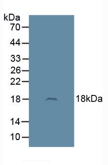 Polyclonal Antibody to Adrenomedullin (ADM)