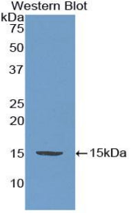 Polyclonal Antibody to Adrenomedullin (ADM)