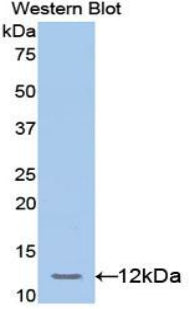 Polyclonal Antibody to Transcription factor 20 (TCF20)