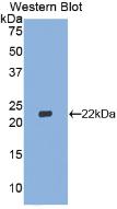 Polyclonal Antibody to Interferon Beta (IFNb)