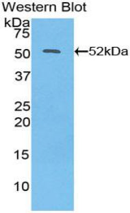 Polyclonal Antibody to Interferon Beta (IFNb)