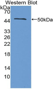 Polyclonal Antibody to Interferon Beta (IFNb)