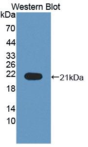 Polyclonal Antibody to Interleukin 1 Receptor Antagonist (IL1RA)