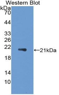 Polyclonal Antibody to Interleukin 1 Receptor Antagonist (IL1RA)