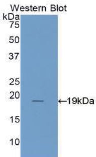 Polyclonal Antibody to Interleukin 1 Receptor Antagonist (IL1RA)