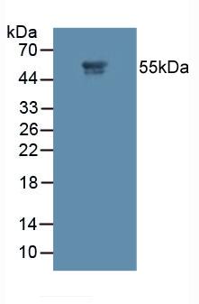 Polyclonal Antibody to Matrix Metalloproteinase 11 (MMP11)