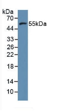 Polyclonal Antibody to Matrix Metalloproteinase 11 (MMP11)