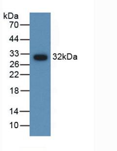 Polyclonal Antibody to Anti-Mullerian Hormone (AMH)