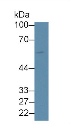 Polyclonal Antibody to Interleukin 2 Receptor Beta (IL2Rb)