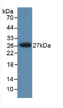 Polyclonal Antibody to Protease, Serine 1 (PRSS1)