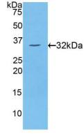 Polyclonal Antibody to Protein Kinase C Eta (PKCh)