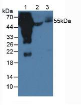 Polyclonal Antibody to Immunoglobulin G4 (IgG4)