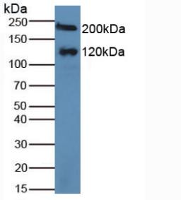 Polyclonal Antibody to Maltase-glucoamylase (MGAM)