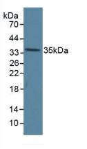 Polyclonal Antibody to Annexin V (ANXA5)